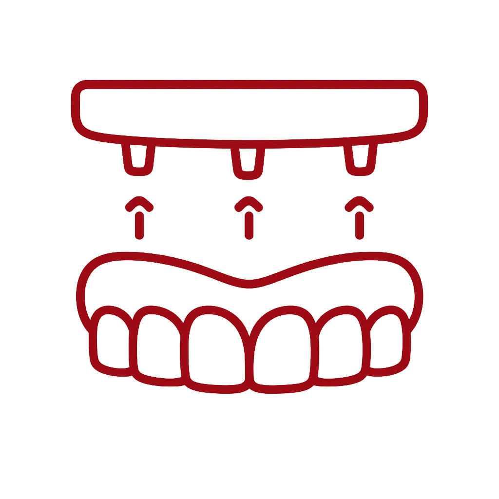 Próteses e implantes
